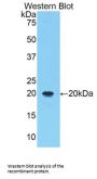 Polyunsaturated Fatty Acid 5-Lipoxygenase (ALOX5) Antibody