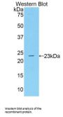 Polyunsaturated Fatty Acid 5-Lipoxygenase (ALOX5) Antibody