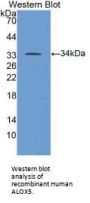 Polyunsaturated Fatty Acid 5-Lipoxygenase (ALOX5) Antibody