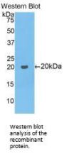 Collagen Type VIII Alpha 1 (COL8A1) Antibody