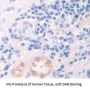 Collagen Type VIII Alpha 2 (COL8A2) Antibody