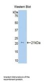 Collagen Type VIII Alpha 2 (COL8A2) Antibody