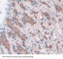 Collagen Type VIII Alpha 2 (COL8A2) Antibody