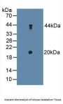 Delta Sleep-Inducing Peptide (dSIP) Antibody