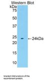Fibroblast Growth Factor 13 (FGF13) Antibody