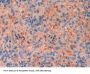 Fibroblast Growth Factor 13 (FGF13) Antibody