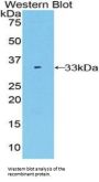 Tissue Alpha-L-Fucosidase (FUCA1) Antibody