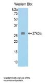Fumarylacetoacetate Hydrolase (FAH) Antibody
