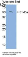 Glucocorticoid Receptor Alpha (NR3C1) Antibody