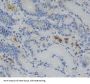 Glucocorticoid Receptor Alpha (NR3C1) Antibody