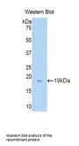 Glucocorticoid Receptor Alpha (NR3C1) Antibody