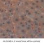 Glucocorticoid Receptor Alpha (NR3C1) Antibody