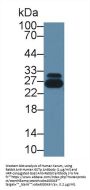 GSTp Antibody