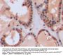 GSTp Antibody