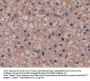 GSTp Antibody