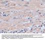 GSTp Antibody