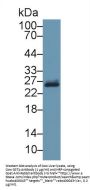 GSTp Antibody