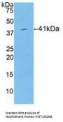 Histone Cluster 1, H2ab (HIST1H2AB) Antibody