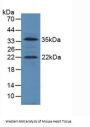 IGF1 Antibody