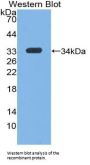 Insulin Like Growth Factor 1 (IGF1) Antibody
