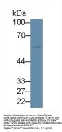 Interleukin 2 Receptor Beta (IL2RB) Antibody