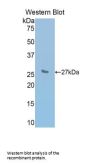 Interleukin 2 Receptor Beta (IL2RB) Antibody