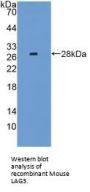 Lymphocyte Activation Gene 3 (LAG3) Antibody