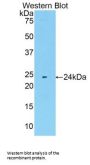 Matrix Metalloproteinase 11 (MMP11) Antibody