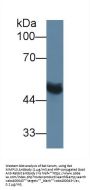 Matrix Metalloproteinase 13 (MMP13) Antibody
