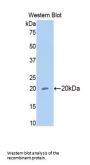 Matrix Metalloproteinase 13 (MMP13) Antibody