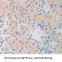 Matrix Metalloproteinase 13 (MMP13) Antibody