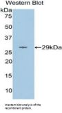 Matrix Metalloproteinase 16 (MMP16) Antibody