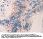Matrix Metalloproteinase 24 (MMP24) Antibody