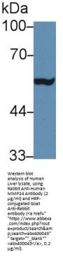Matrix Metalloproteinase 24 (MMP24) Antibody
