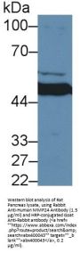 Matrix Metalloproteinase 24 (MMP24) Antibody