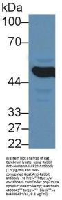 Matrix Metalloproteinase 24 (MMP24) Antibody