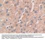Matrix Metalloproteinase 24 (MMP24) Antibody