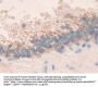 Matrix Metalloproteinase 24 (MMP24) Antibody