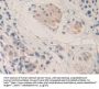 Matrix Metalloproteinase 24 (MMP24) Antibody