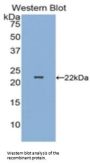 Parkinson Disease Protein 7 (PARK7) Antibody