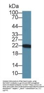 Parkinson Disease Protein 7 (PARK7) Antibody