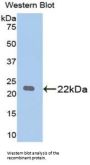 Parkinson Disease Protein 7 (PARK7) Antibody