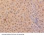 Parkinson Disease Protein 7 (PARK7) Antibody