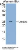 Pyruvate Kinase, Liver And RBC (PK) Antibody