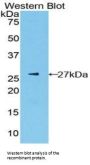 Pyruvate Kinase, Liver And RBC (PK) Antibody