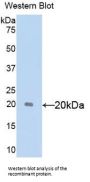 Sex Hormone Binding Globulin (SHBG) Antibody