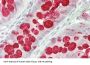 Trefoil Factor 3 (TFF3) Antibody