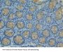 Trefoil Factor 3 (TFF3) Antibody