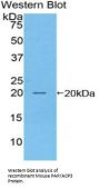 Prostatic Acid Phosphatase (ACP3) Antibody