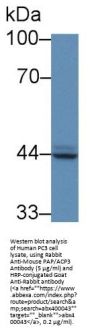 Prostatic Acid Phosphatase (ACP3) Antibody